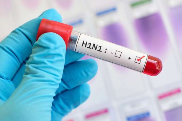 ზამთრის სეზონზე H1N1-ის ვირუსის პირველი შემთხვევა დაფიქსირდა