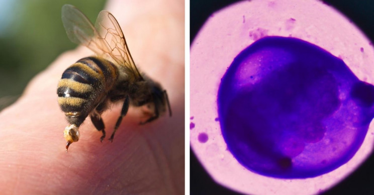 ფუტკრის შხამში შემავალი მოლეკულა ძუძუს კიბოს უჯრედებს ანადგურებს - უახლესი კვლევები
