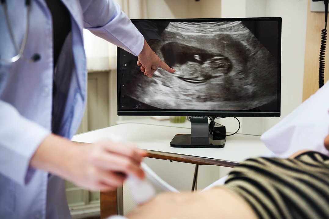 ​ორსულობის რა ვადაზე შეგვიძლია ნაყოფის სქესის გაგება?